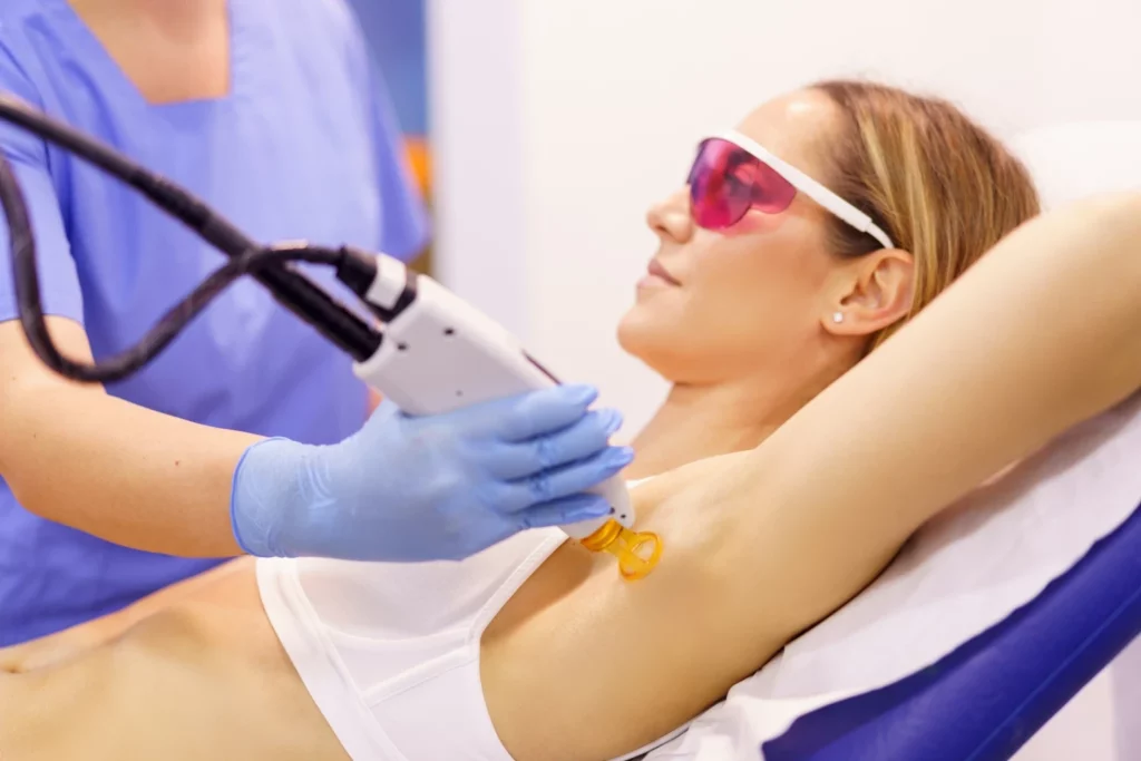laser hair removal before and after