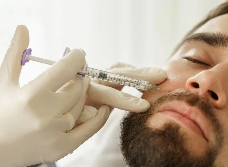 What Are Smile Lines