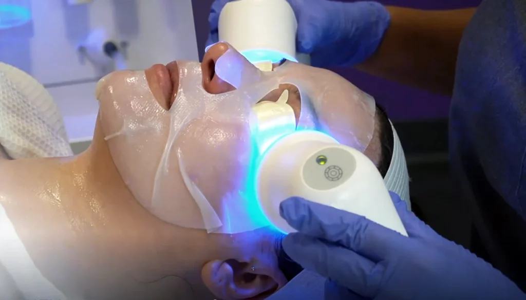 glace hydrodermabrasion facial
