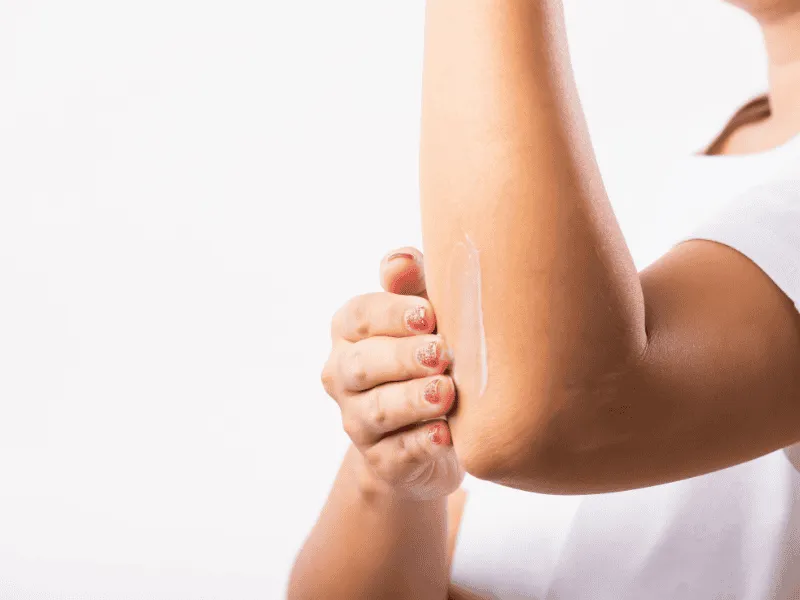 dark spots on elbows