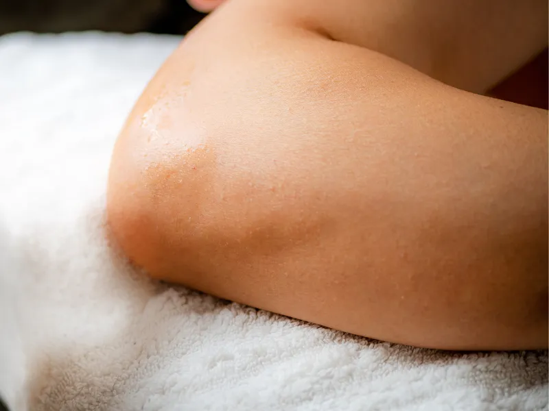 elbow whitening redondo beach