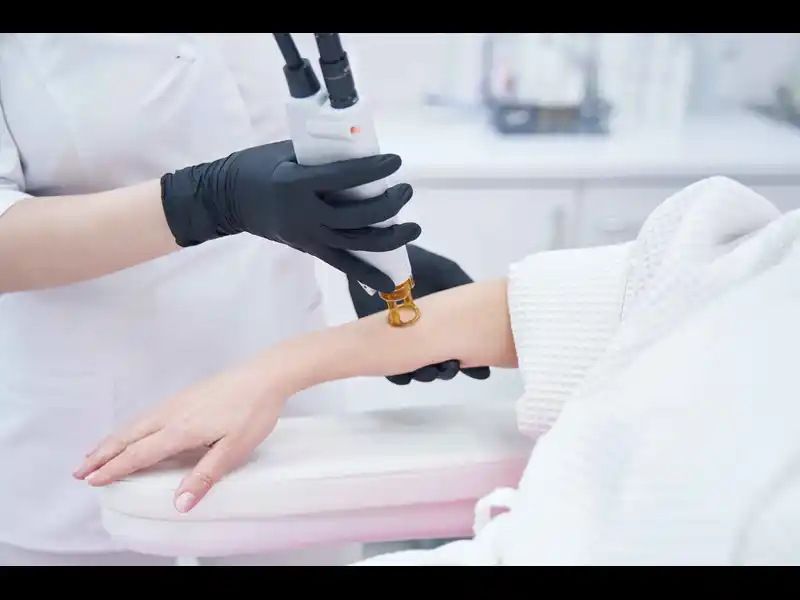 what are faicial filler