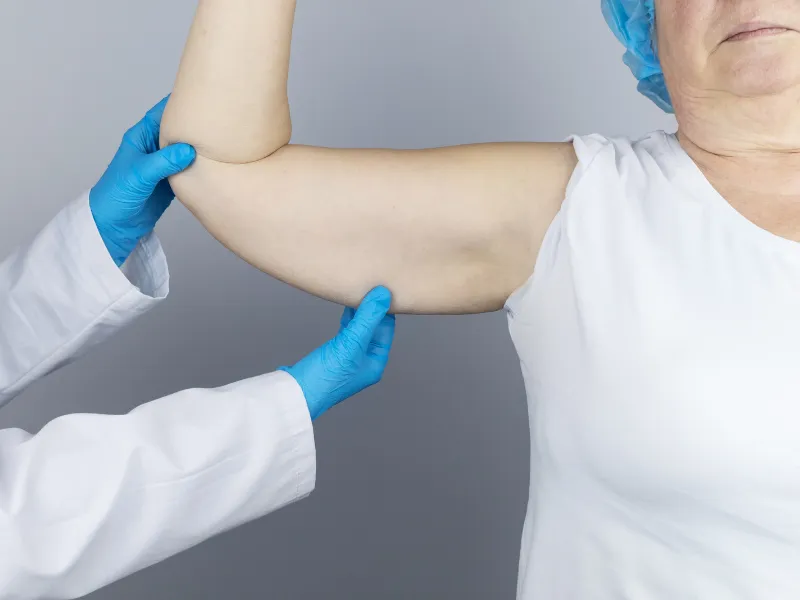 arm lift redondo beach