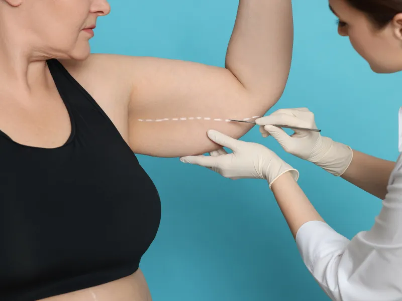 candidate for arm contouring treatment