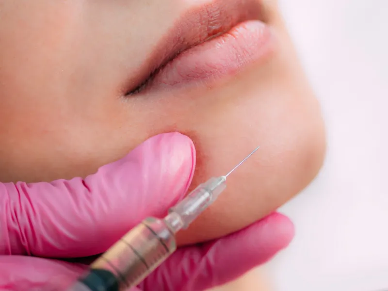 dermal fillers el segundo