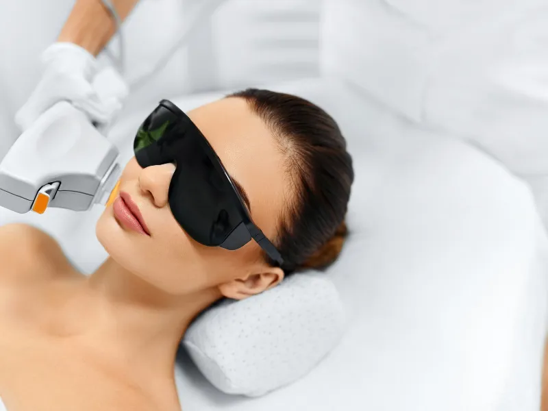 ipl photofacial