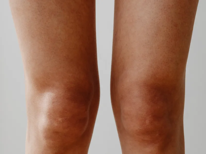 what is knee whitening