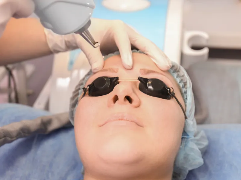 benefits of laser eyebrow tattoo removal