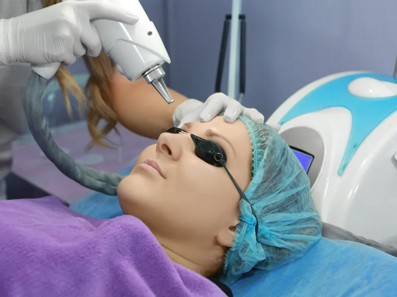 laser removal of eyebrow tattoo