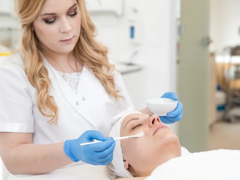 what is chemical peel