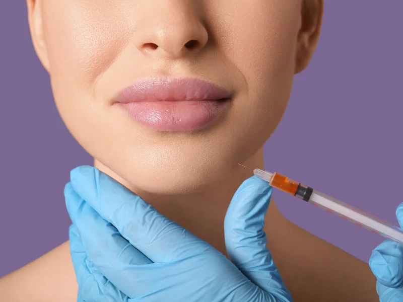 chin filler los angeles