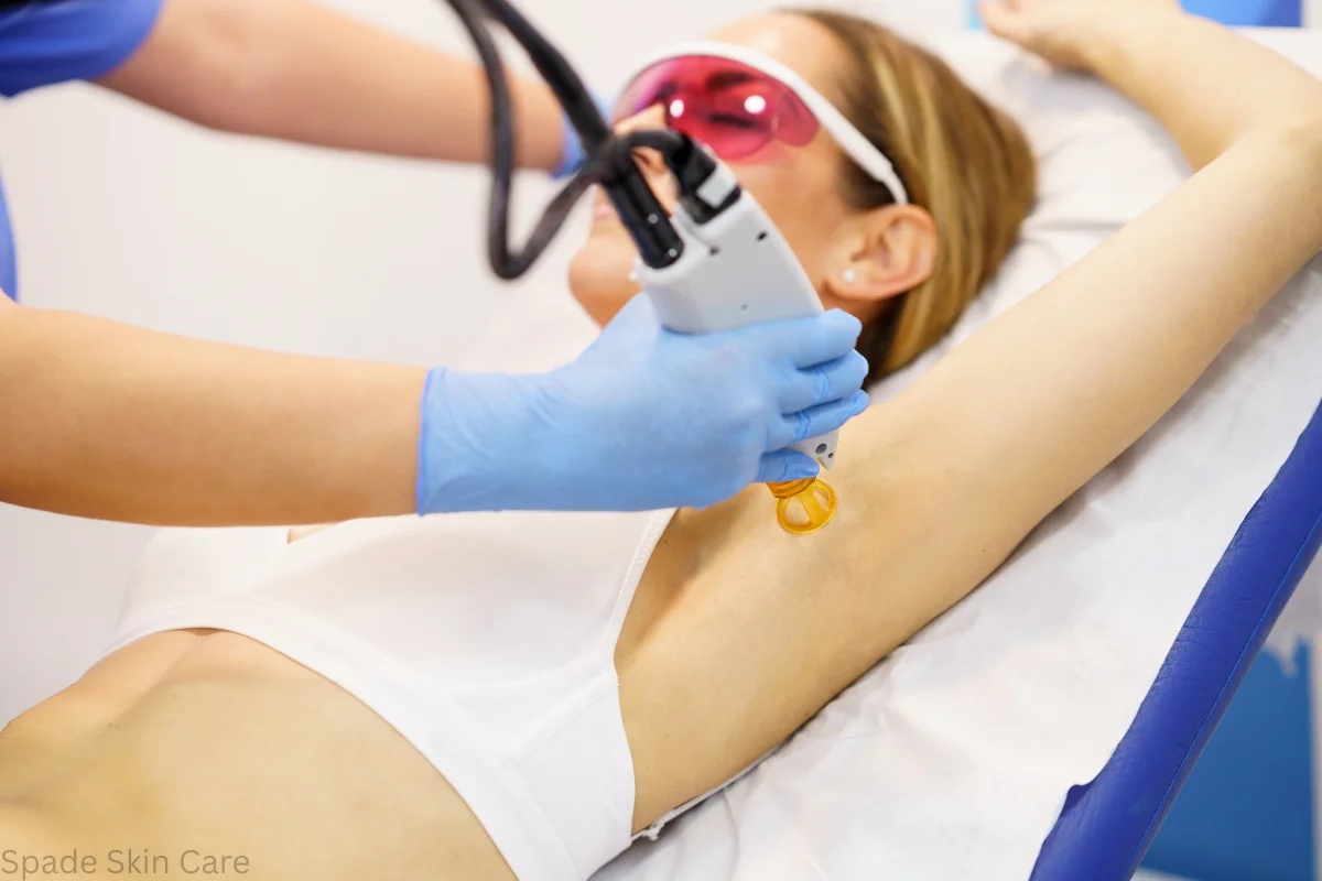 underarm laser hair removal procedure